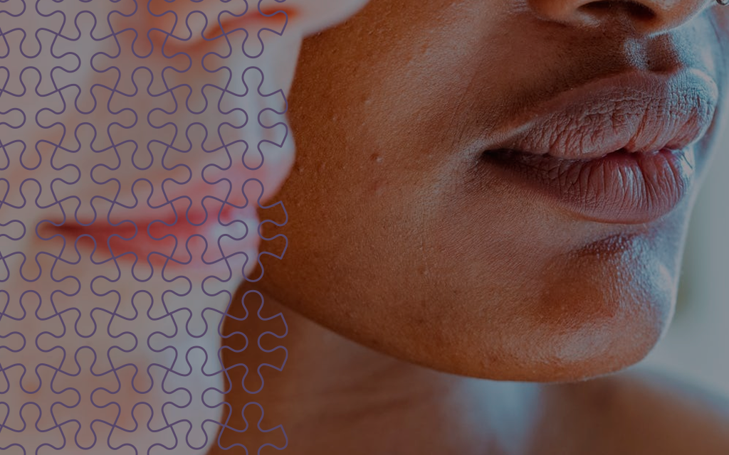 Atuação Fonoaudiológica em Estética Facial